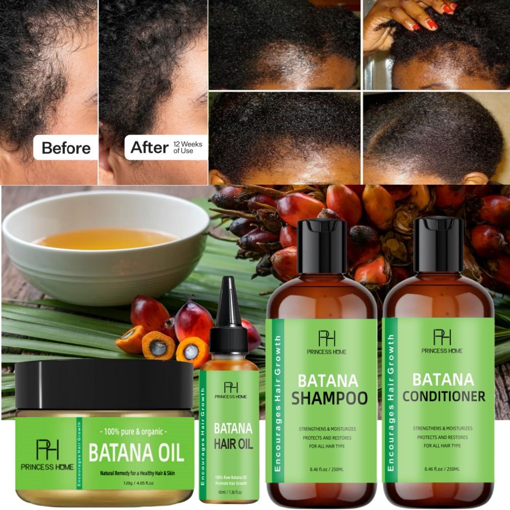 Hair Growth Batana Oil Serum – Fast-Growing Hair, Anti-Hair Loss & Repairing Essence