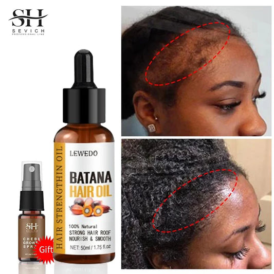 Hair Growth Batana Oil Serum – Fast-Growing Hair, Anti-Hair Loss & Repairing Essence