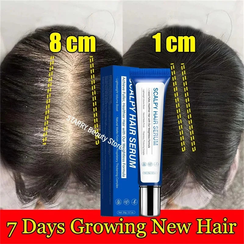 Fast Hair Growth Serum – Anti-Hair Loss & Hair Regrowth Oil for Men & Women |