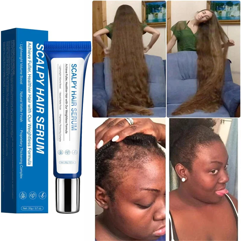 Fast Hair Growth Serum – Anti-Hair Loss & Hair Regrowth Oil for Men & Women |